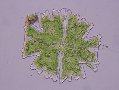 水滴中的观赏藻类 Micrasterias 100x