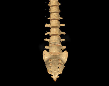 显示人体脊柱轮廓的腰椎 3D 渲染 CT 扫描。