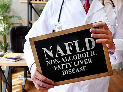 肝细胞摄影照片_非酒精性脂肪肝疾病 NAFLD 医生举着牌子。