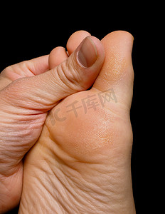大拇指对大脚趾按摩对 b 隔离的干性皮肤的压力