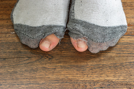 破旧的袜子有洞和脚趾。