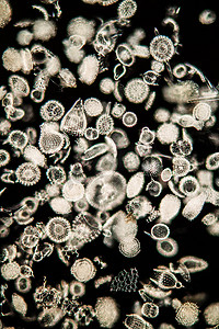 100x 显微镜下的放射虫海洋动物