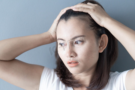 女性严重脱发问题的保健洗发水和美容