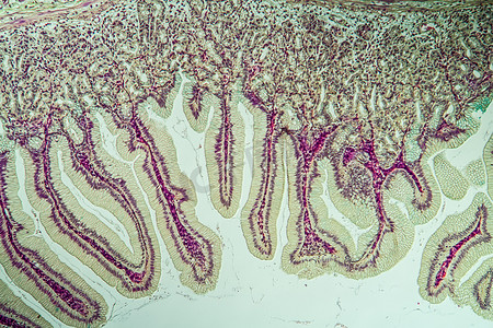 溃烂摄影照片_显微镜下有憩室组织的大肠 10