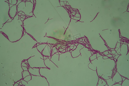 200美金摄影照片_200x 显微镜下的炭疽芽孢杆菌