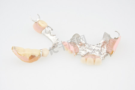 假的摄影照片_由塑料和金属制成的假牙顶部和底部