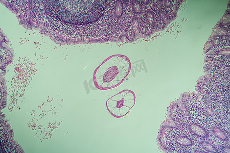 Oxiuris，肠道蛲虫，显微镜 100 倍