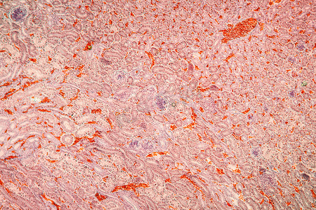 100x 显微镜下的肾脏组织