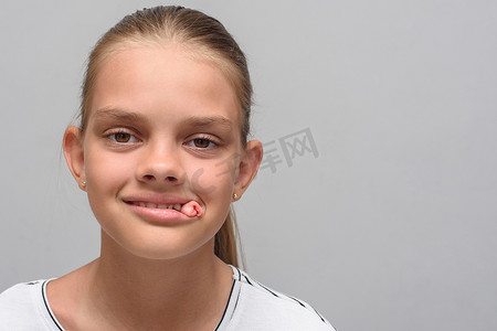 一个十岁女孩的肖像，拔牙后卫生棉条从她嘴里伸出来