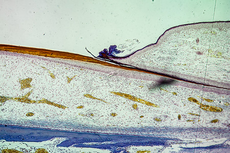 指甲甲床摄影照片_100x 显微镜下的甲床组织