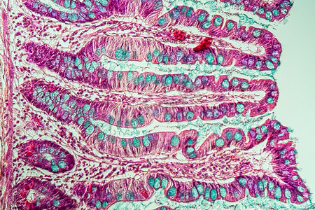 200x 显微镜下有绒毛的小肠