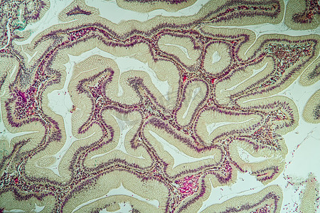 显微镜下有憩室组织的大肠 10