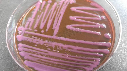 琼脂上有各种细菌菌落的培养皿