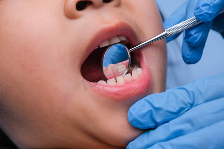 一个长着漂亮洁白牙齿的健康儿童的口腔特写。