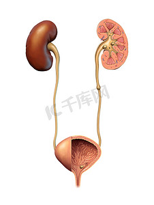 肾结石和尿路结石