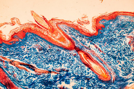 100x 显微镜下头皮与发根组织