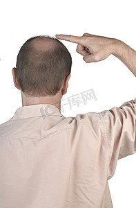 地中海秃头卡通摄影照片_人类脱发 — 成年男子用手指着他的秃头
