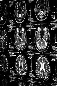 脑实验室摄影照片_人脑 ct 扫描的非常清晰的图像