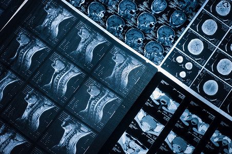 颈部和大脑的几张 CT 计算机断层扫描图像