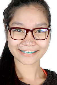 戴牙套摄影照片_戴着眼镜和牙套的亚洲年轻女孩的肖像