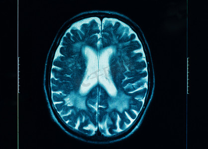 成象摄影照片_人脑的锐利 ct 扫描