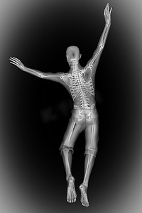 人体骨骼射线照相扫描图像