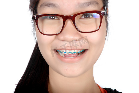 戴着眼镜和牙套的亚洲年轻女孩的肖像