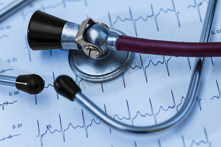 用于心血管医学检查的心电图脉冲轨迹和听诊器概念