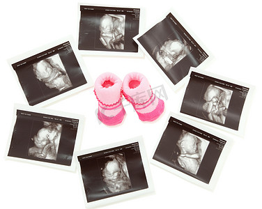 一双粉红色婴儿靴周围的一组 3D/4D 超声图像
