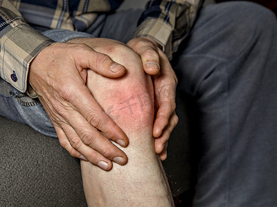 膝盖胀痛摄影照片_年长人握他的手膝盖疼痛