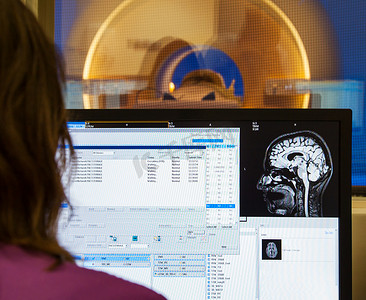 扫描仪大脑 MRI X 射线医院