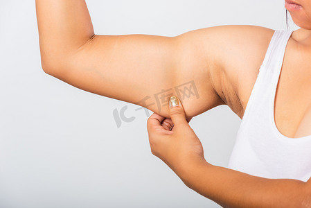亚洲女性腋下多余脂肪、腋下皮肤问题的特写
