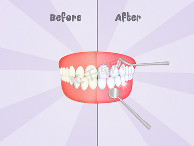 清洁牙齿之前和之后