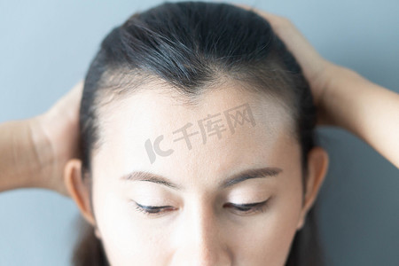 女性严重脱发问题的保健洗发水和美容