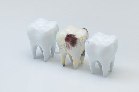 美白牙齿图标摄影照片_腐烂的牙齿旁边有白色的牙齿，3d 渲染。