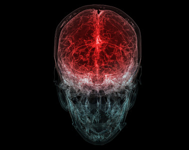 头部大脑动脉的 3D 渲染医学准确图示