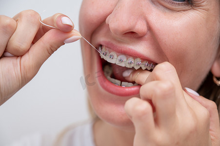 白人妇女用牙套用牙线清洁牙齿。