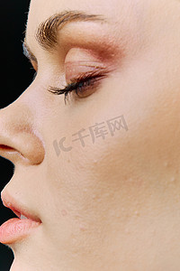 以护理为主题，对皮肤有问题的女性脸部进行近距离微距摄影。
