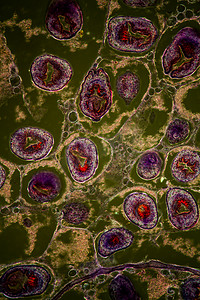 肝细胞摄影照片_棘球蚴寄生肝吸虫放大 100 倍