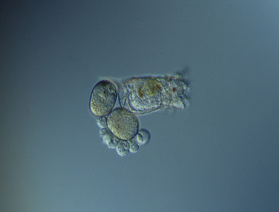 显微镜下轮虫在水中游泳