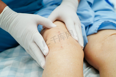 医生在医院检查接受疤痕膝关节置换手术的亚洲老年妇女患者。