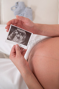 一名不露面的孕妇坐在白色沙发上，手里拿着一张胎儿的超声波照片。