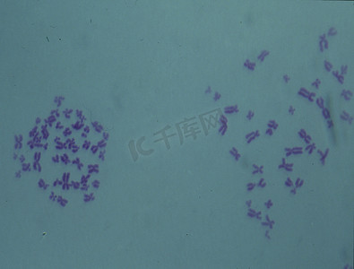 染色体摄影照片_细胞核中的染色体