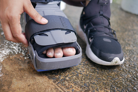 带有灰色塑料靴脚踝支撑伤害保护靴的女性断脚