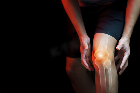 医学概念，患有膝盖疼痛的人 — 骨骼 x-r