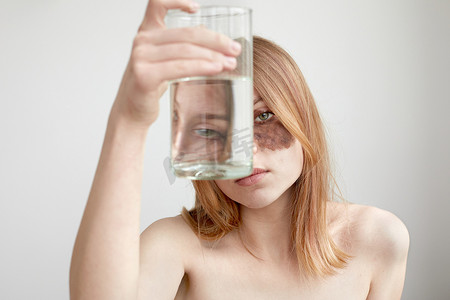 脸色暗淡摄影照片_拿着一杯水的患有黄褐斑的女人