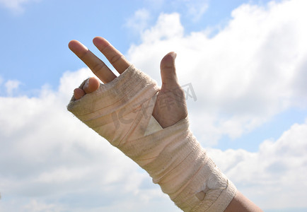 弹性绷带手腕疼痛的人在天空背景下锻炼手指