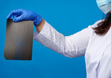 乳汁摄影照片_一件白色外套和蓝色乳汁手套的医生拿着a的X-射线