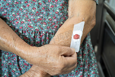 抽血摄影照片_亚洲老年或老年老妇患者在每年进行身体健康检查以检查胆固醇、血压和血糖水平的抽血测试后，显示棉毛止血。