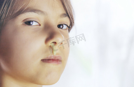 流口水的孩子摄影照片_孩子脸上的鼻涕特写。